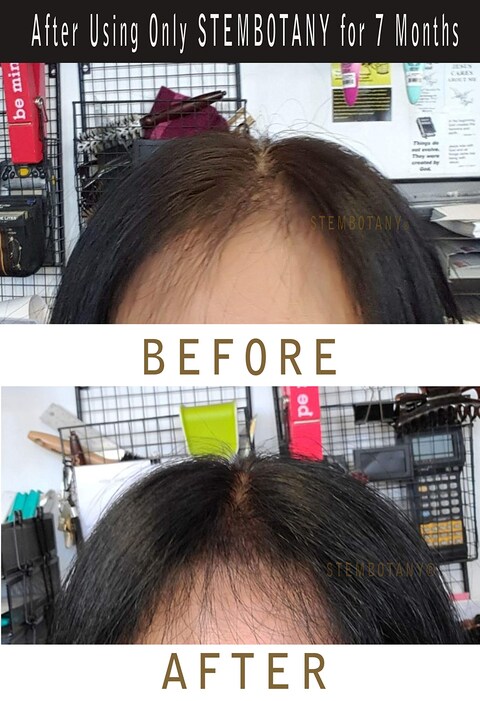 Stem Cell Shampoo for Thinning Hair  Hair Loss Shampoo for women Super Glossy Ultimate ColorSafe Natural DHT Blocker Shampoo with Caffeine Peptides Stem Cells for Hair