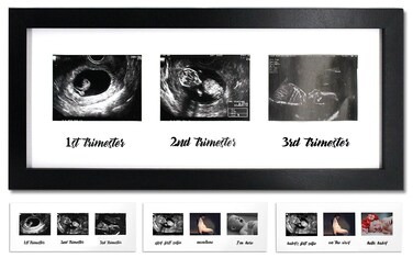 IHEIPYE Triple Sonogram Pregnancy Frame &ndash; Baby Ultrasound Picture Frame with Story for Expecting Parents, Baby Shower Frame, Baby Grow Through All Three Trimesters Frame, Nursery Decor, Black