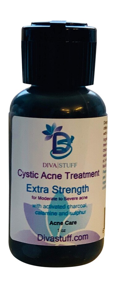 Cystic Acne Spot Treatment Bottle, for Moderate to Severe Acne, Made With Activated Charcoal, Fast Acting Formula Reduces Inflammation and Dries Out the Blemish Quickly, By Diva Stuff
