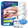 Mouth Guard for Grinding Teeth at Night, Night Guards for Teeth Grinding, Mouthguards for Grinding of Teeth, Mouth Guard for Clenching Teeth at Night with 12 Cleaning Tablets