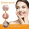 40Pcs Hydrocolloid Acne Patches Full-Face Coverage Kit for Pimples &amp; Blemishes, Skin Care Solution for Clearing Spots