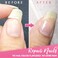 5ml Instant Cracked Nail Repair Gel, Nail Strengthener, Phototherapy Glue, Nail Recovery for Restore Weak Nails, Broken Nail, Damaged Nails - Instantly Fill in and Fix Nail Cracks Flawlessly (1pc)