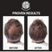 Hair Regrowth Serum- Maximum Strength DHT Blocker. Repairs &amp; Stimulates New Follicle Hair Growth. Grow Stronger, Thicker, Fuller, Longer, Healthier Hair. For Men &amp; Women with No Side Effects.