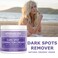 Whitening Labs Dark Spot Corrector - Anti-Aging Moisturizer for Face, Body, Sensitive Areas, Men &amp; Women