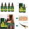 Magik 4-8 Pack Ginger Hair Growth Serum Germinal Oil Regrow 7 Days Loss Treatment (4 Pack)