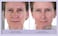 My Perfect Facial &ndash; Travel Size Skin Care Set   At-Home Anti-Aging Treatment   Instant Face Lift, Firming &amp; Toning   Reduces Fine Lines, Wrinkles, Pores &amp; Skin Discoloration (5 Treatments)