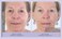 My Perfect Facial &ndash; Travel Size Skin Care Set   At-Home Anti-Aging Treatment   Instant Face Lift, Firming &amp; Toning   Reduces Fine Lines, Wrinkles, Pores &amp; Skin Discoloration (5 Treatments)