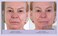 My Perfect Facial &ndash; Travel Size Skin Care Set   At-Home Anti-Aging Treatment   Instant Face Lift, Firming &amp; Toning   Reduces Fine Lines, Wrinkles, Pores &amp; Skin Discoloration (5 Treatments)