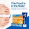 Dr. Paul's Piggy Paste Gel 2-Pack. Restores Brittle, Yellow Toe Nails and Fingernails and Makes Them Clear and Healthy Again. Two Tubes equals a 6 Month Supply&hellip;
