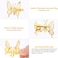 3D Moving Butterfly Hair Clips,Metal Butterfly Hairpins Bride Wedding Head Pieces Hair Accessories for Women Girls (Gold)
