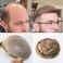 SIMBEAUTY Super Natural Hairline Human Hair Mens Toupee Free Style 10x8 inch Thin Skin Hairpieces Replacement Systems Men Hair (0.06mm skin, 20, medium dark blonde)