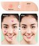 Acne pimple patch Skin care facial Hydrocolloid acne absorbing cover patches cute heart fashion, Blemish Spot, Skin Treatment, Facial Stickers 36pc, pink, 1.47cm 6pcs;0.98cm 12pcs