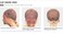 BOBBI BOSS HD Lace Front Wig MediFresh 13X4 Deep Lace MLF241 Rhian (DL427(BobbiBoss)), DLBobbiBoss