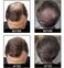 gowwim Hair Thickening Fibers 2-in-1 Kit Keratin Building Fibers, Spray Applicator &amp; Hold Spray - Instantly Volumize Sparse Areas (Light brown)