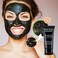 SHILLS Blackhead, Removes Blemishes, Purifyies, Cleanses Skin. Activated Charcoal (50 ml)