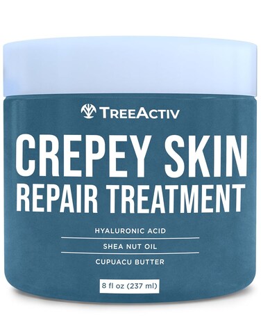 TreeActiv Crepey Skin Repair Treatment Original Formula, 8 fl oz, Firming Cream For Face &amp; Neck, Skin Firming Lotion with Hyaluronic Acid, Crepey Skin Treatment to Address Dry Crepe Skin