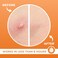 PatchRx Pimple Patches for Face (240 Patches), Hydrocolloid Acne Patches, Pimple Patch Pimple Stickers, Hydrocolloid Patch Acne Dots Acne Pimple Patches For Face, Zit Patches, Acne Spot Treatment