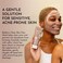 BOLDEN Clear Skin Clay Mask   Made with Sulfur for Deep Pore Cleansing &amp; Preventing Breakouts   Pore Minimizer and Oil Reducer for Sensitive Skin   3.5 fl oz