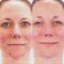 Rodan + Fields UNBLEMISH Invisible Matte Defense Broad Spectrum SPF 30   Skincare Moisturizer   UV Skin Protection   Sunscreen Face and Neck Cream