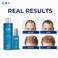ALIKA Combo Shampoo And Serum Set Hair Growth For Men, Grow Gorgeous Hair Growth, Hair Loss Treatments, Suitable For Dry, Oily, Normal Scalp
