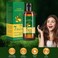 Lidoria Ginger Anti Hair Loss 7 Days,Lidoria Ginger Anti Hair Loss,Ginger Oil for Hair Growth,Ginger Essential Oil Repair Damaged Hair for Stronger Thicker Longer Hair (2PCS)