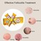 TKTT Folliculitis Cream, Folliculitis Treatment Cream, Effective Treatment for Scalp Folliculitis Body,Face, Professional Treatment Folliculitis,20g*2pcs