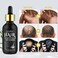 5% Minoxidil for Men and Women Hair Growth Serum Oil, 2.02 oz Hair Regrowth Serum with Biotin for Scalp Hair Loss, Natural Hair Regrowth Treatment for Stronger Thicker Fuller Healthier Hair