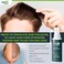 Transplant Clinical Repair Serum - 60ml Hair Regrowth Serum - Prevents Post-Transplant Hair Loss - Stimulates New Hair Growth - Fast and Effective Results - Gentle Formula