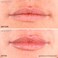 Lips 5 ML (5 ML) Lip Plumper