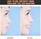 Maitys 2 Sets Nose Up Lifting Shaper Clip Clipper Nose Shaper Nose Up lifter Inserts Shaping Clip Silicone Nose Beauty Tools Invisible Nose Slimming Device for Wide Nose (Black)