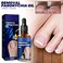 6PCs German Toenailcare Removal Paronychia Oil, Ingrown Toenail Nail Repair, German Toenailplus Oil Nail Renewal Liquid