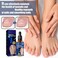 6PCs German Toenailcare Removal Paronychia Oil, Ingrown Toenail Nail Repair, German Toenailplus Oil Nail Renewal Liquid