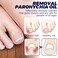 6PCs German Toenailcare Removal Paronychia Oil, Ingrown Toenail Nail Repair, German Toenailplus Oil Nail Renewal Liquid