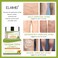 IDUCEN Body Cream,Varicose Veins Cream, Varicose Veins Treatment for Legs,Varicose Veins Cream for Legs Eliminate Varicose Veins and Spider Veins, Relieve Pain of Legs