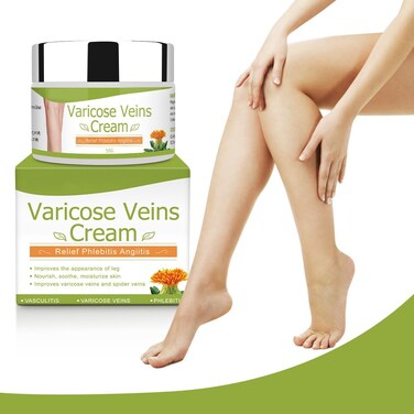IDUCEN Body Cream,Varicose Veins Cream, Varicose Veins Treatment for Legs,Varicose Veins Cream for Legs Eliminate Varicose Veins and Spider Veins, Relieve Pain of Legs