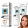 Dark Spot Remover For Body,Dark Spot Corrector Cream,- Underarm, Neck, Armpit, Knees, Elbows, Private Areas, Intimate Areas (Acanthosis Nigricans Therapy 2Box)