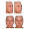 Serious Skincare Black Pearl Deep Wrinkle Decrease Face Moisturizer to Reduce Appearance of Lines &amp; Wrinkles - Anti Aging Cream For Face &amp; Neck with Hydrating Peptides &amp; Caviar Extract - 1.7 oz.