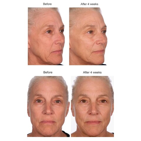 Serious Skincare Black Pearl Deep Wrinkle Decrease Face Moisturizer to Reduce Appearance of Lines &amp; Wrinkles - Anti Aging Cream For Face &amp; Neck with Hydrating Peptides &amp; Caviar Extract - 1.7 oz.