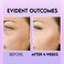 Eye Bag Remover, Under Eye Dark Circle Remover with Retinol &amp; Caffeine, Under Eye Brightener, Anti Aging Eye Tightening Cream to Repair Wrinkles and Fine Lines