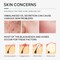 Skin Care Set,Acne Treatment for Face Skin Care Sets &amp; Kits,Tea Tree Essential Oil Facial Skincare Gift Set with Cleanser,Toner,Serum,Gel, Acne Treatment Kit Cream Skin Care for Teens 10-12 Girls Boys