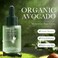 Avocado Skincare Set, 6-In-1 Skincare Gift Set For Teenage Girls - Cleanser, Serum, Face &amp; Eye Cream, Toner, Lip Balm, Facial Kit Anti-Aging Skin Care Kit For Women, Face Care Set Birthday Gifts