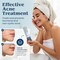 Clear Choice Mandelic Acid Face Cleanser 6.7oz &ndash; Gentle Exfoliating Gel with Turmeric &amp; Enzymes for Acne, Fine Lines, and Pigmentation &ndash; Deep Cleansing, Non-Irritating, Suitable for All Skin Types