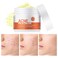 Acne Cream, Salicylic Acid Cystic Acne Treatment For Face, Back Butt Acne Treatment Cream, Acne Spot Treatment for Face and Body, Acne Clearing Cream Pimple Cream for Teens &amp; Adults, Acne Moisturizer