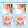 2024 New Bloskin Double Chin Mask Reusable,Bloskin Lifting Face Mask,V Line Lifting Mask for All Skin Types for Lifting and Firming the Face (5Pcs)