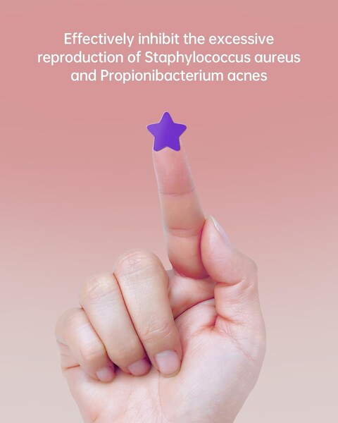 Star Acne Pimple Patch 140 Counts, Hydrocolloid Acne Patches for Face, Purple, Blue, Green, Pink and Yellow