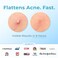 Hydrocolloid Pimple Patches (Made in Korea) FSA/HSA Eligible, Vegan, Hypoallergenic, Cruelty-Free   Acne Stickers, Overnight Treatment - for Zits, Spots, Pimples, Whiteheads (10 Count, XL Patches)