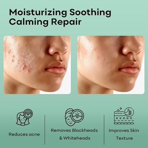 Centella Asiatica Hydrating Face Masks Skincare, Moisturizing Soothing Calming Repair Facial Sheet Mask, Deeply Hydrates and Improve Dullness 30g, 7 packs
