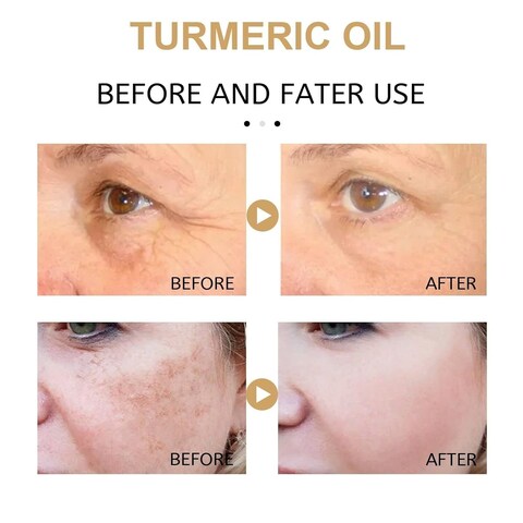 2 Pack Turmeric Oil, Natural Turmeric Oil Serum for Face,Skin Care Moisturizing Serum(30ml)