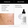 Asterwood Matrixyl 3000 + Argireline Serum 1 oz + 10% Niacinamide Serum 1 oz