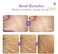 Argireline Matrixyl 3000 Serum,Plump up Skin, Anti Aging, Instantly Firming, Liposomal Retinol, Collagen Boost Peptides Serum For Face Neck Eyes Breast 1oz (SINGLE)